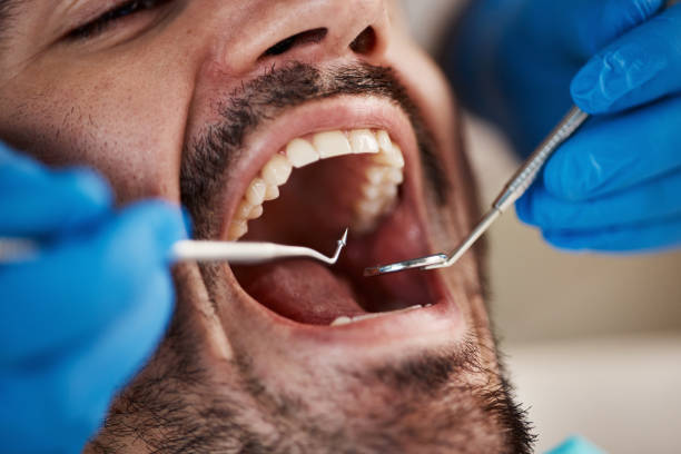 Best Emergency Dental Surgery in Beckett Ridge, OH