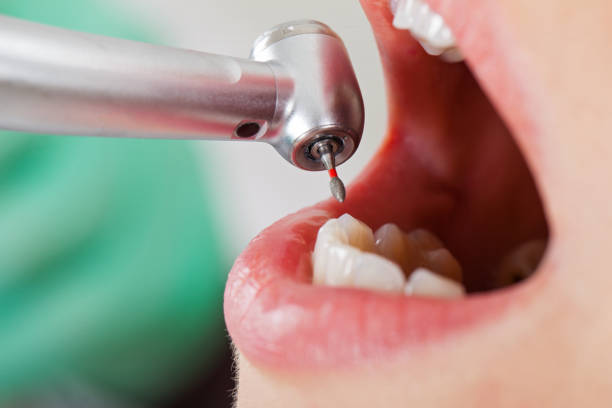 Best Emergency Broken Tooth Repair in Beckett Ridge, OH